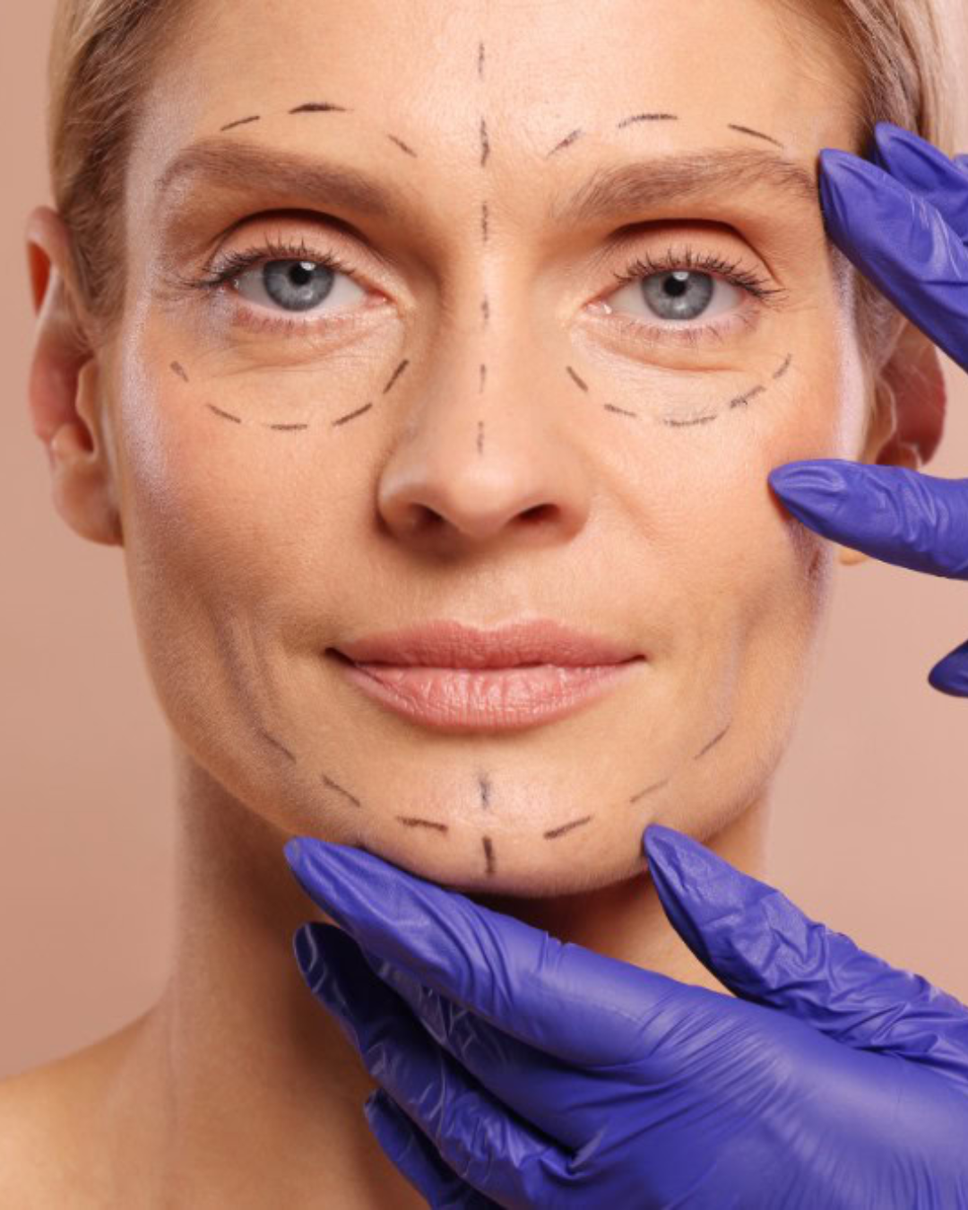 Restylane Fillers: Which Type Is Right for You?