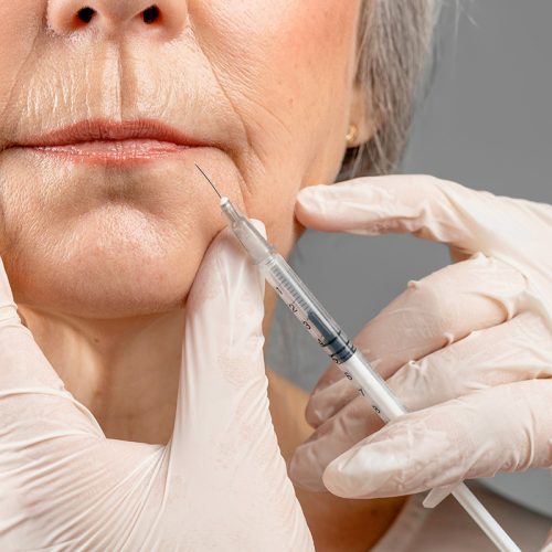 What to Expect When Getting Restylane: Before, During, and After